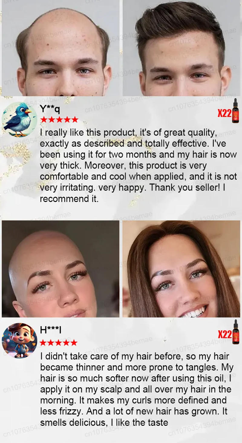 Description Picture 5 of itemHair Growth Oil Fast Hair Growth Effective Baldness Repair Hereditary Hair Loss Postpartum Hair Loss Seborrheic Hair Loss