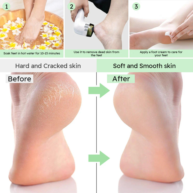 Description Picture 6 of itemProfessional Rechargeable Electric Callus Remover for Feet with Dust Collection & Waterproof Design Pedicure Tool