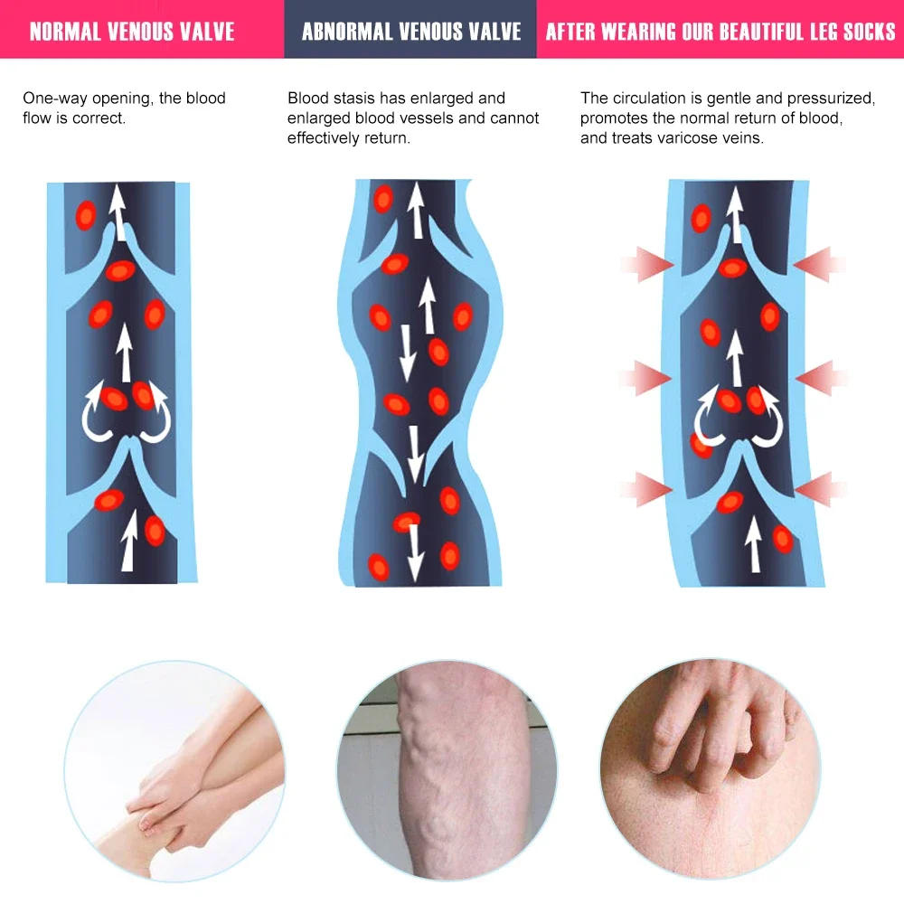 Description Picture 6 of item1Pair Thigh High Footless Compression Sleeves with Silicone Band for Women & Men, Firm 20-30 mmHg Leg Sleeves Graduated Support