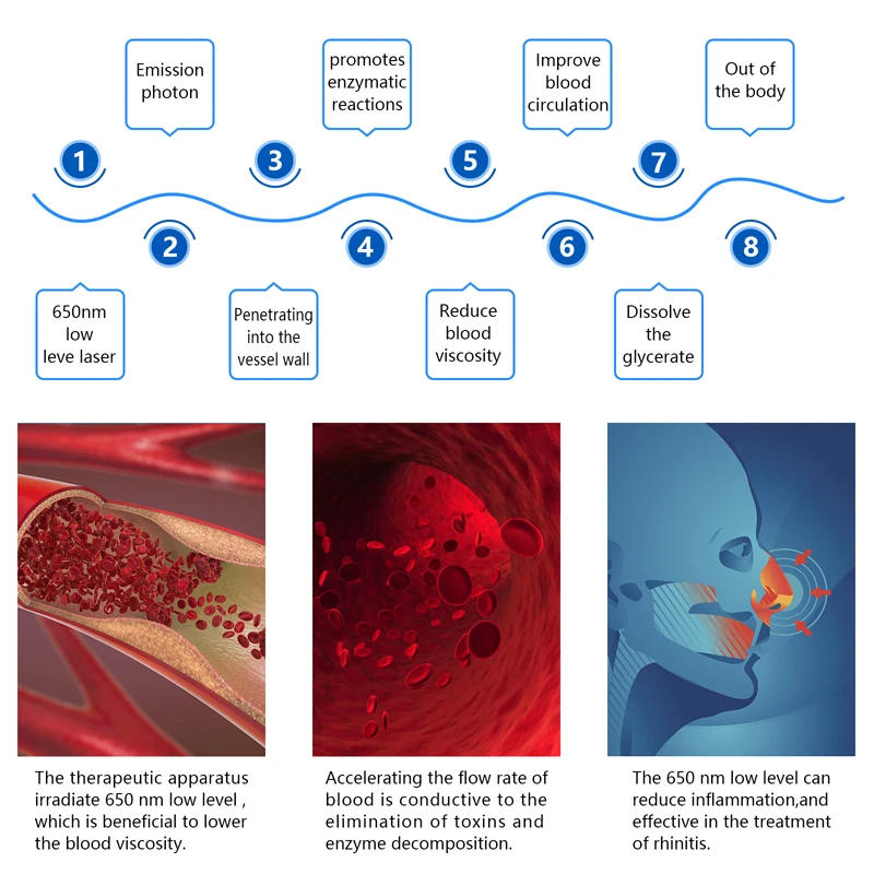 Description Picture 6 of itemKTS 650nm Laser Wrist for Diabetes Hypertension Sinusitis Heart Rate 12 Holes Semiconductor Laser Instrument Home Physiotherapy