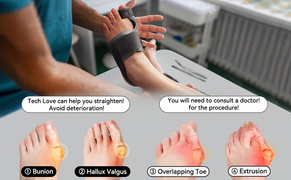 Description Picture 6 of itemTech Love Hallux Valgus Corrector Toe Straightener Best for Toe Alignment and Bunion Pain Relief Foot Care Tools