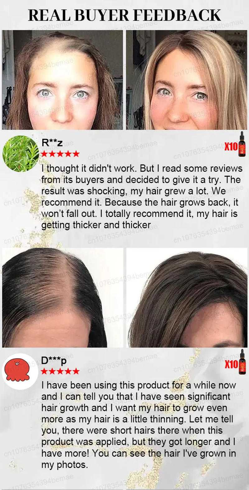 Description Picture 4 of itemHair Growth Oil Fast Hair Growth Effective Baldness Repair Hereditary Hair Loss Postpartum Hair Loss Seborrheic Hair Loss