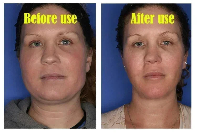 Description Picture 6 of itemEffective V-Shape Face Slimming Lifting Facial Cream Lift Up V Double Chin Cheek Slimming Firming Anti Wrinkle Beauty Skin Care