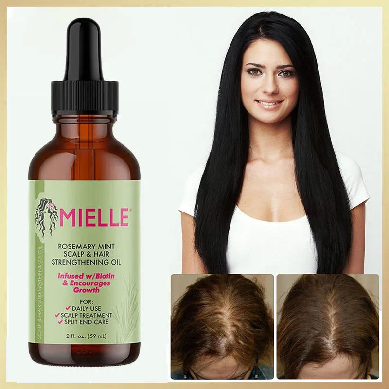 Description Picture 6 of itemUnisex Hair Growth Oil Hair Loss Treatment Rapid Hair Growth Effective Baldness Repair Hereditary Postpartum Hair Loss