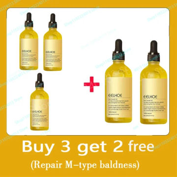 Hair growth oil,effective baldness repair, hereditary hair loss, postpartum hair loss