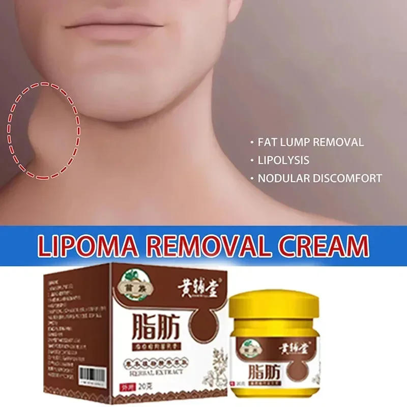 Description Picture 3 of itemLipoma Removal Cream Relief Swelling Fat Elimination Cream Remove Subcutaneous Lump Extract Care Fat Bulges Lump