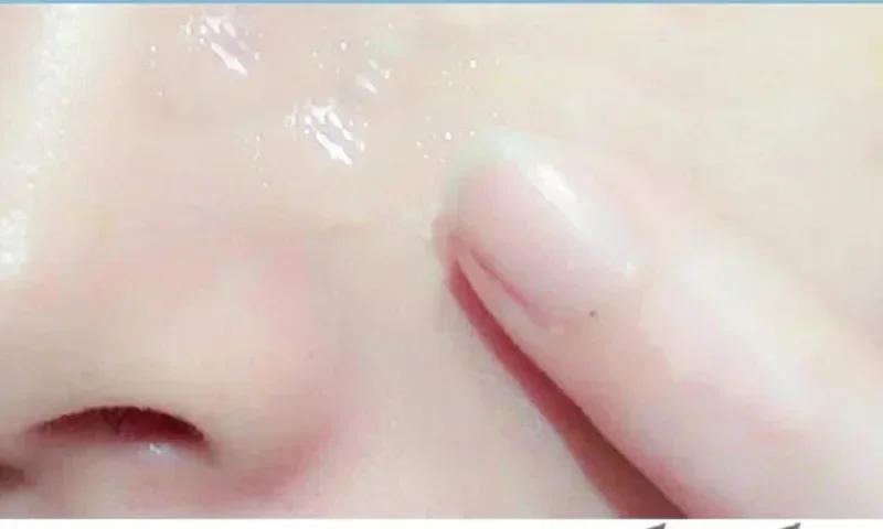 Description Picture 4 of item20ml Salicylic Acid Face Cream Shrink Pore Rejuvenate Moisturising Nourish Blackheads Remove Cream Anti-aging Oil Control Serum