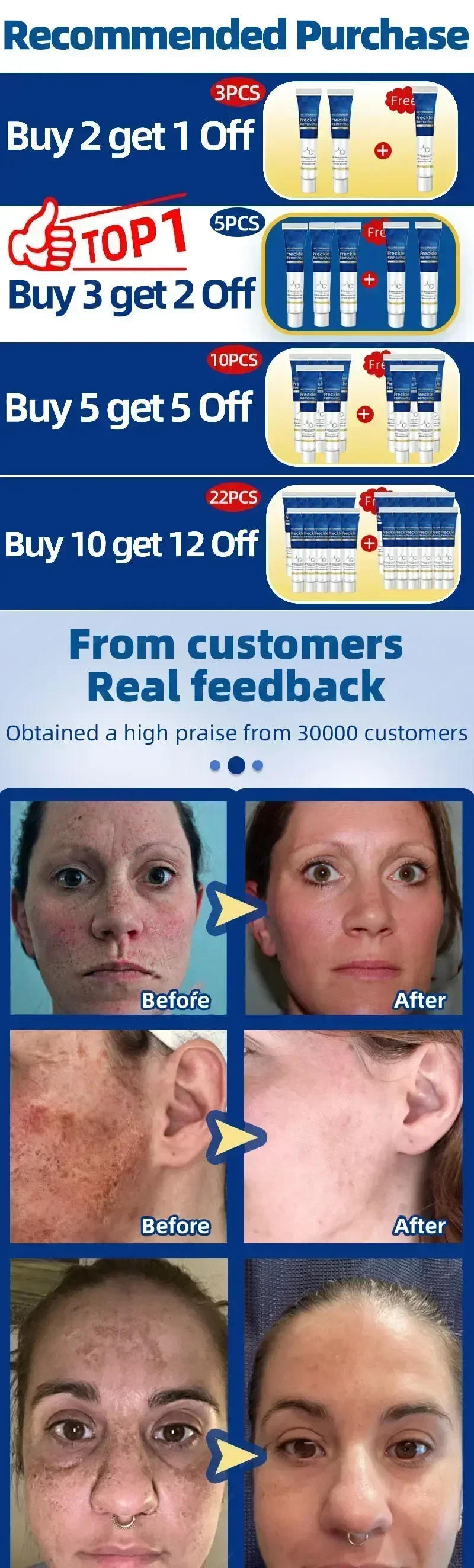 Description Picture 3 of itemPowerful Whitening Cream Skin Care Remove Freckle Melasma Dark Spots Corrector Lighten Melanin Pigmentation Brighten Product