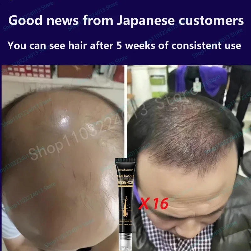 Description Picture 4 of itemNatural Hair Growth Hair Roots Fast Grow Anti Hair Loss Serum Liquid Scalp Damaged Treatment Repair Beauty Health