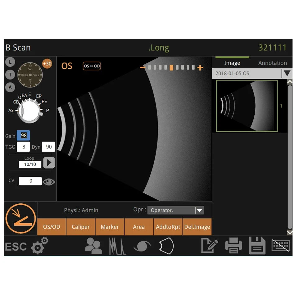 Description Picture 6 of itemAist Ophthalmic Ultrasound Scanner Optical A/B Scanner AB Scan Testing Equipment Ophthalmology Device Biometry Eye Scanner