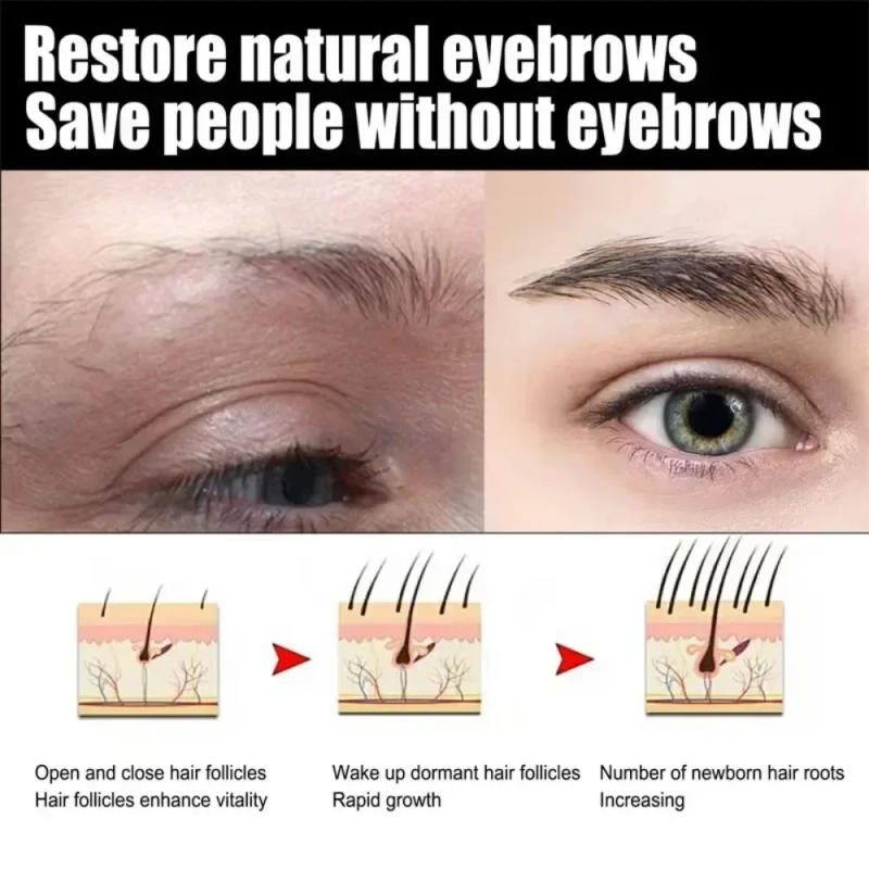 Description Picture 4 of itemEyebrow Growth Serum Eyelash Hair Growth Anti Hairs Loss Product Prevent Baldness Fuller Thicker Lengthening Eyebrow Makeup 30ml