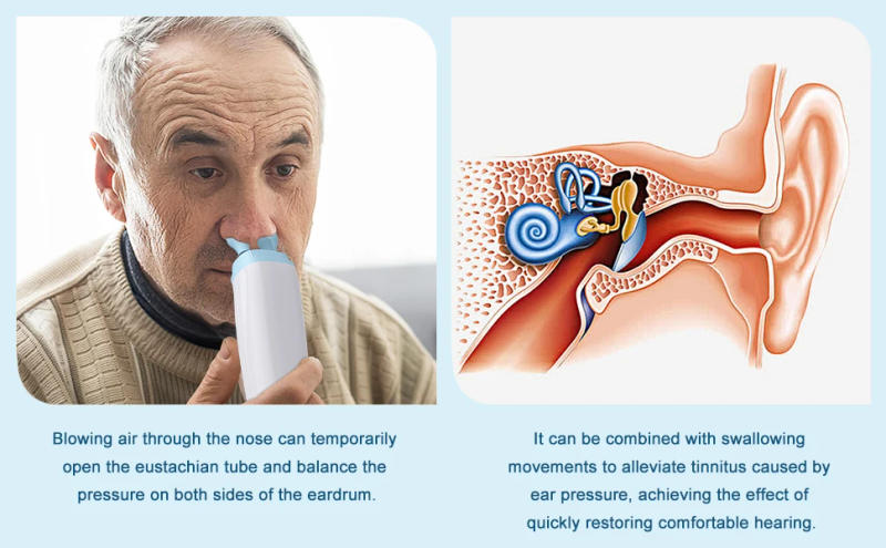 Description Picture 3 of itemElectric Tinnitus Relief Device Ear Pressure Expander Treat Ringing Relieve Pain Dizziness Otitis Improve Hearing Ear Care Tools