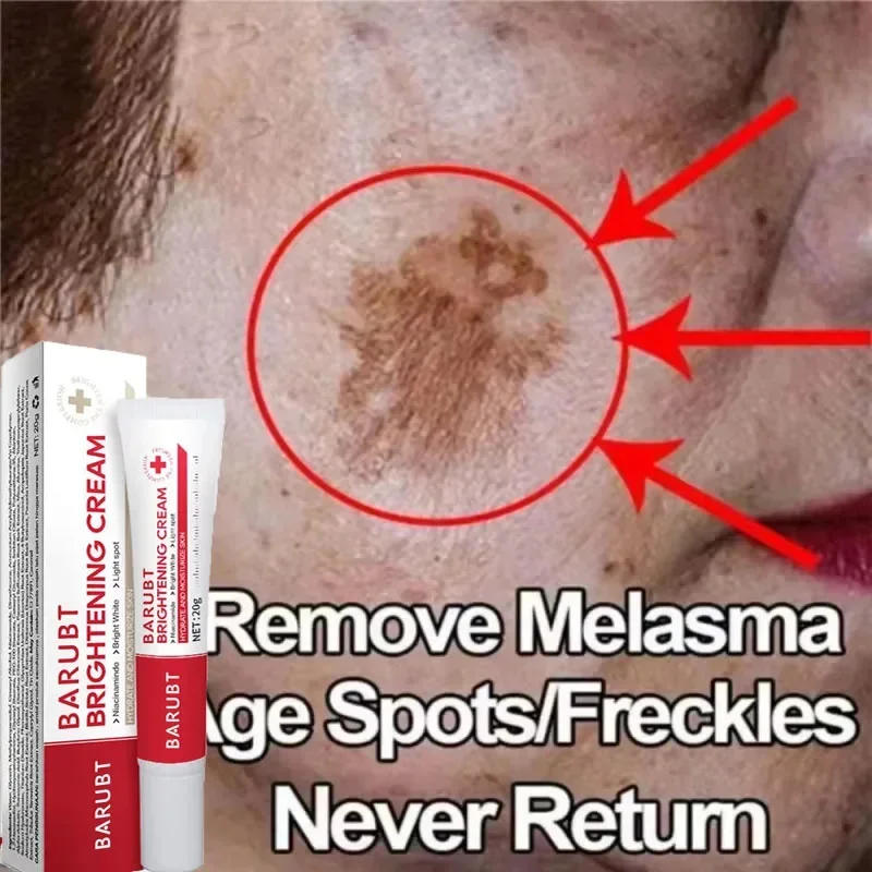 Description Picture 4 of itemWhitening Freckles Face Cream Removal Melasma Dark Spots Corrector Lighten Melanin Pigmentation Brighten Anti-Aging Beauty Care