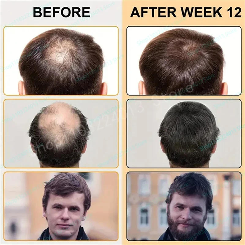 Description Picture 6 of itemNatural Hair Growth Hair Roots Fast Grow Anti Hair Loss Serum Liquid Scalp Damaged Treatment Repair Beauty Health