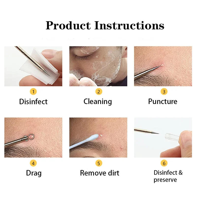 Description Picture 3 of itemBlackhead Remover Squeeze Acne Needle Tweezers Alema Blackheads Cell Clip 5 Extractor Pimples Comedon Black Dots Nose Sebum Tool