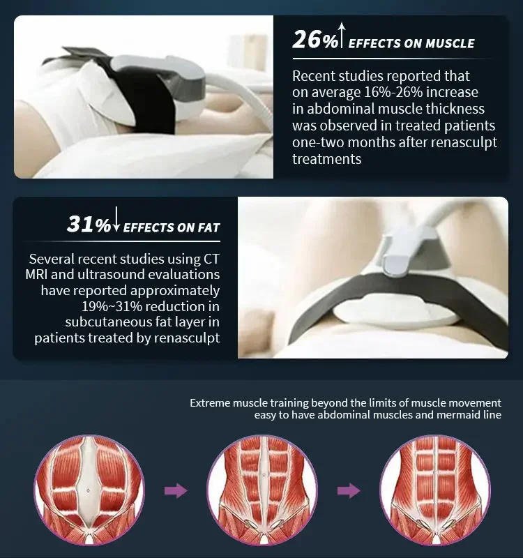 Description Picture 5 of itemWeight lose Portable Electromagnetic Body   Slimming Muscle Stimulate Fat Removal Body Slimming build muscle Machine