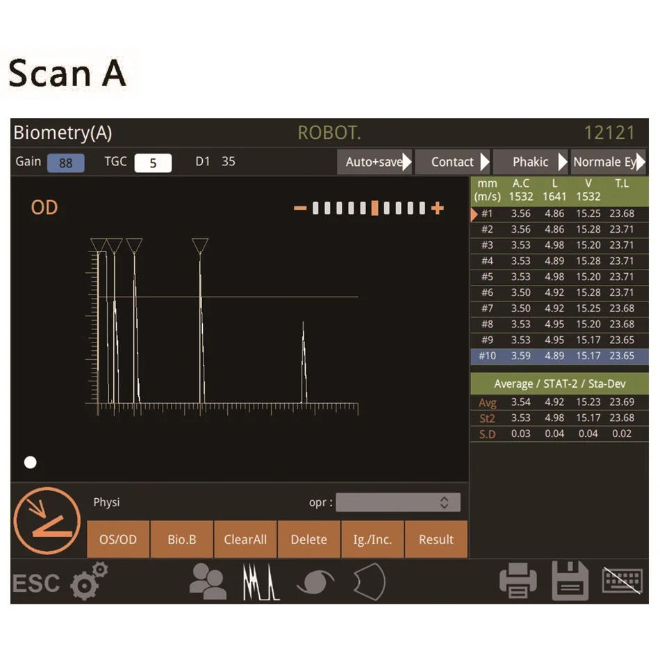 Description Picture 4 of itemAist Ophthalmic Ultrasound Scanner Optical A/B Scanner AB Scan Testing Equipment Ophthalmology Device Biometry Eye Scanner