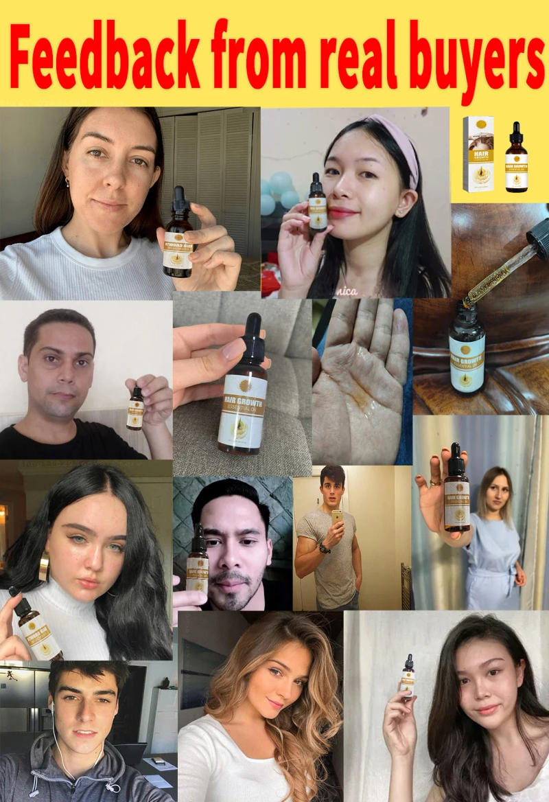 Description Picture 2 of itemHair Growth Essential Oil Anti Hair Loss Serum Hair Regrowth Essence Treatment Alopecia Prevent Baldness Nourish Scalp 30ml