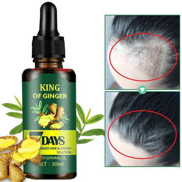 7Days Ginger Hair Growth Spray Serum For Anti Loss Essential Oil Products Fast Treatment Prevent Hair Thinning Dry Frizzy Repair