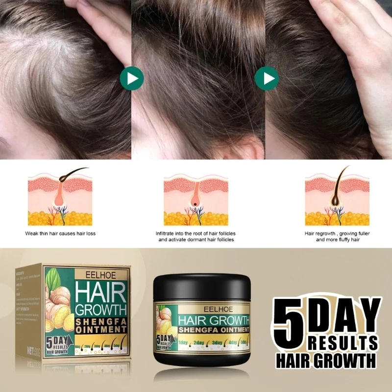 Description Picture 6 of itemSdatter EELHOE Ginger Oil Vitamin E Oil Hair Growth Cream Moisturizing Care Essence Hair Scalp Loss Massage Hair Conditioners