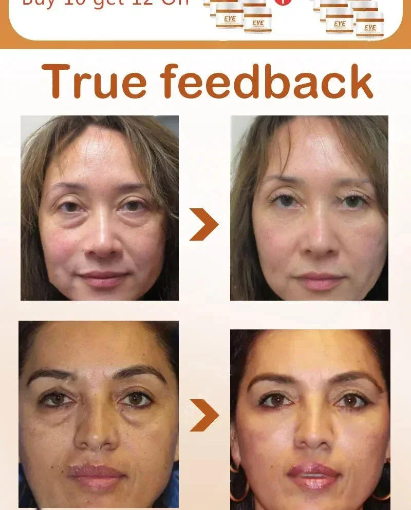 Description Picture 4 of item26 Anti-Aging Moisturizer Eye Cream Dilutes Around The Eyes To Remove Dark Circles, Eye Bags, Collagen Firming Eye Cream