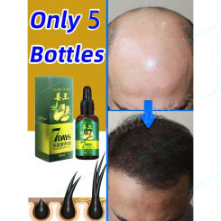 Ginger Hair Growth Spray Serum For Anti Hair Loss Essential Oil Products Fast Treatment Prevent Hair Thinning Dry Frizzy Repair