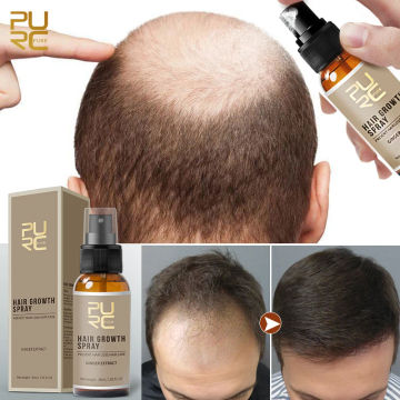 PURC Ginger Hair Growth Spray Anti Hair Loss Scalp Treatment Fast Regrowth Thicken Care Serum Hair Growth Products for Men Women