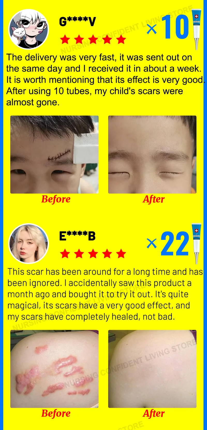 Description Picture 4 of itemDeep scar healing Scar gel for all new and old scars