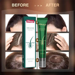 Scalp hair root growth essence