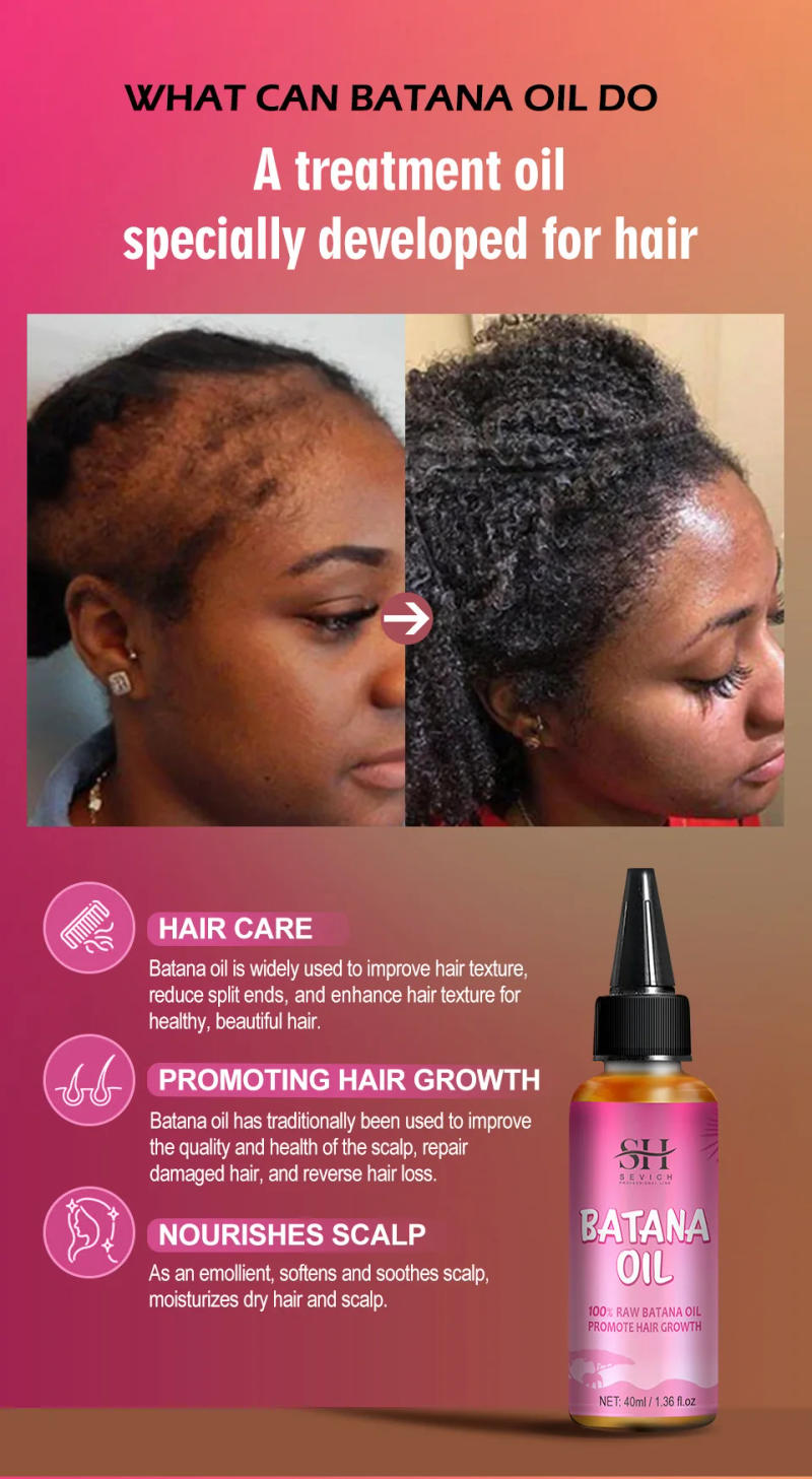 Description Picture 5 of itemNaturals batana oil Fast Hair Growth for Men Women Pure batana oil Nourish Shiny Hair Healthy Hair Care Anti Hair Loss Sevich