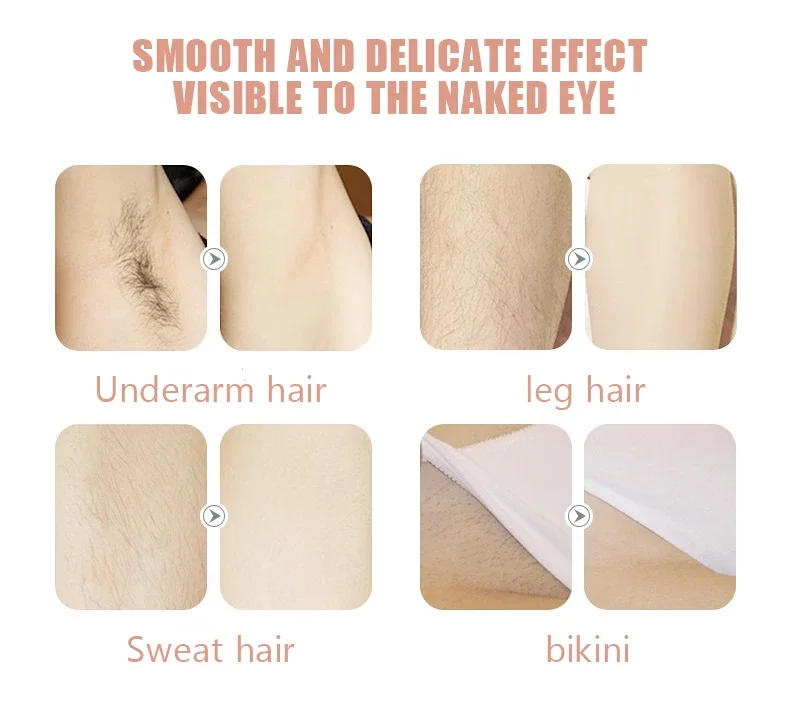 Description Picture 5 of item3 in 1 Epilator Electric Shaver for Women Lady with Detachable Head Hair Remover Penetration USB for Face Leg Bikini Trimmer