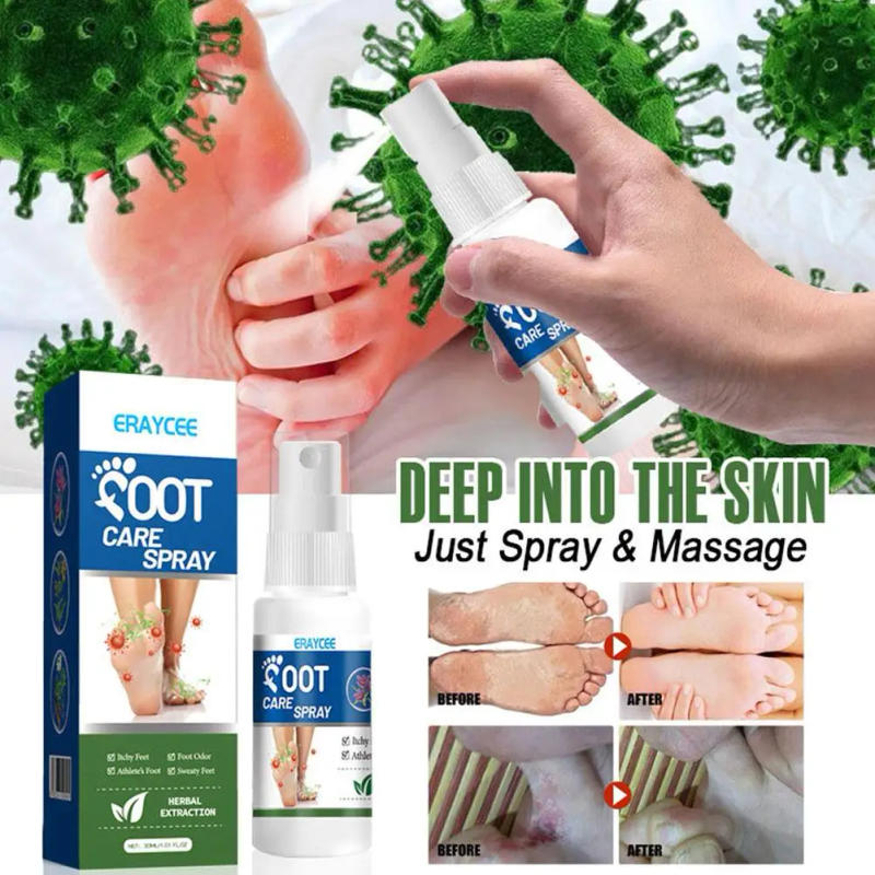 Description Picture 2 of item30ml Foot Deodorant Spray Relieve Itching Eliminate Spray Athlete's Foot Of Moisturize The Removal Foot Care Odor Anti-Swea B9M2
