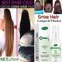 Ginger Hair Growth Serum Spray Natural Anti Hair Loss Products Nourish Hair Roots Fast Regrowth Hair Care Essence For Men Women