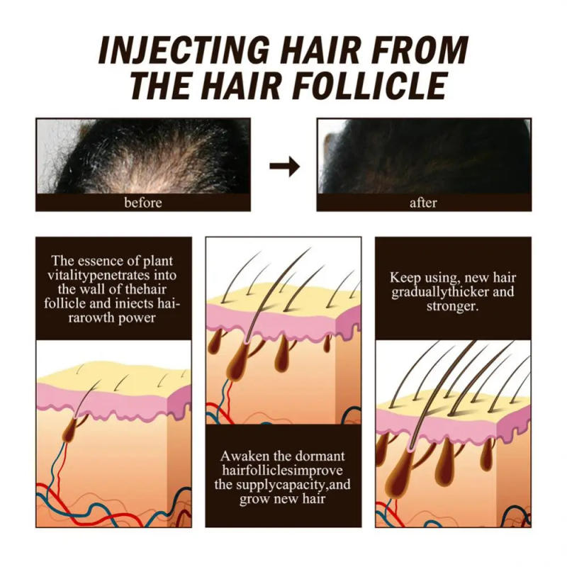 Description Picture 4 of item20ml Ginger Dense Hair Spray Hair Root Fast Growth Moisturizing Dry Hair Tough Fixing Hair Anti-drop Repair Hair Root Hair Care