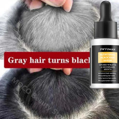Gray White Hair Treatment Serum Liquid White To Black Natural Color Repair Products Anti Loss Nourishing Hair Care For Men Women