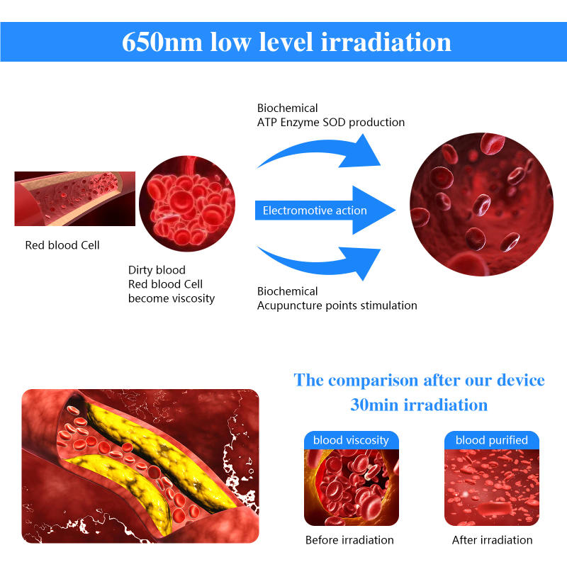 Description Picture 5 of itemKTS 650nm Laser Wrist for Diabetes Hypertension Sinusitis Heart Rate 12 Holes Semiconductor Laser Instrument Home Physiotherapy