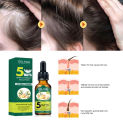 5 Days Ginger Hair Growth Essential Oil Products Anti Hair Loss Serum Fast Growing Nourish Soften Scalp Repair Damaged Hair Care