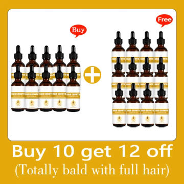 Effective Hair Growth Oil For Men Women Biotin Fast Treatment Baldness Repair Hereditary Postpartum Serum