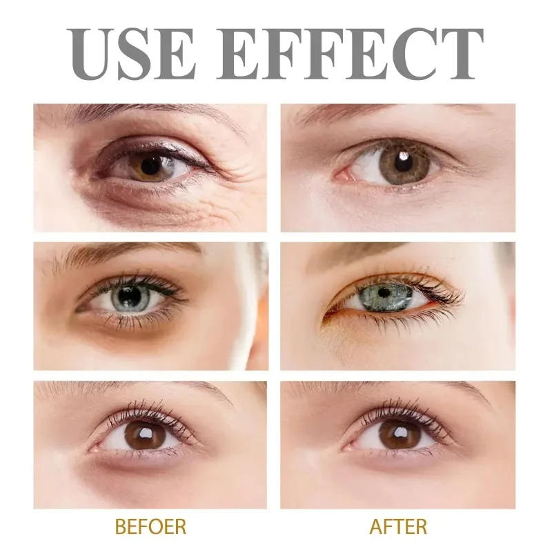 Description Picture 3 of itemEye Cream Removes Dark Circles Tightens The Eyes Lifting Firming And Removing Eye Bags Make Your Eyes More Lively