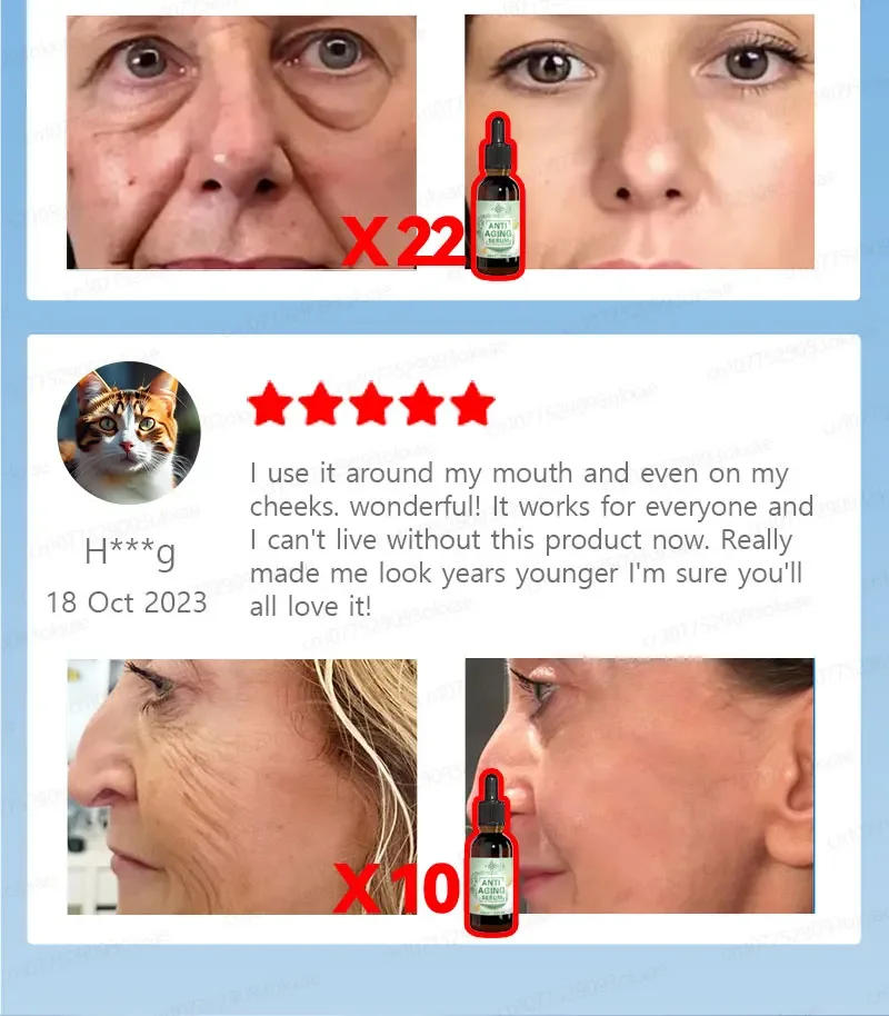 Description Picture 5 of itemwrinkles disappeared