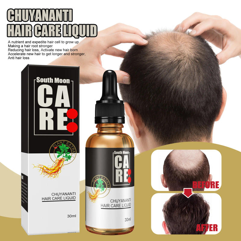 Description Picture 2 of itemAnti hair loss and hair growth liquid for hair growth, dense hair, and hair fixing herbal plant extract hair essence