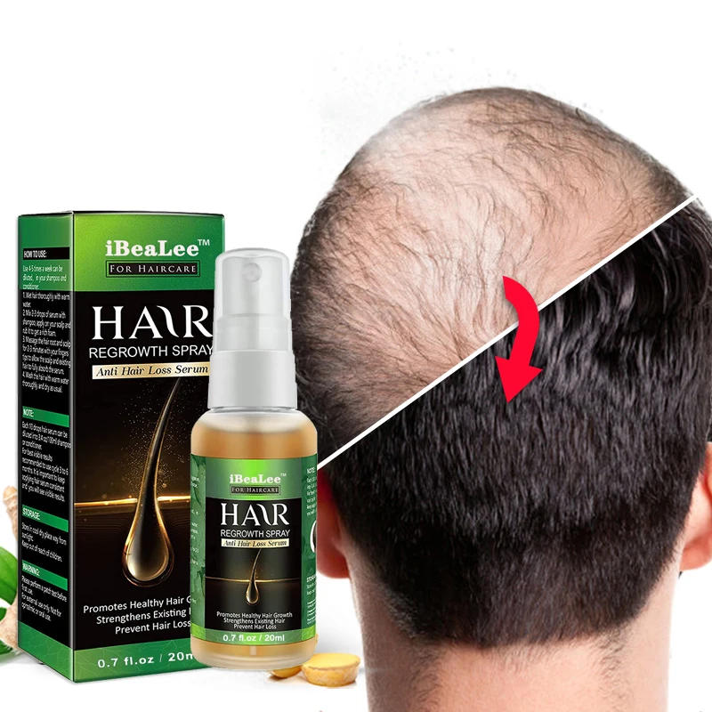 Description Picture 2 of itemGinger Fast Hair Growth Spray Products Anti Hair Loss Serum Prevent Baldness Treatment Scalp Dry Damaged Hair Beauty Health Care