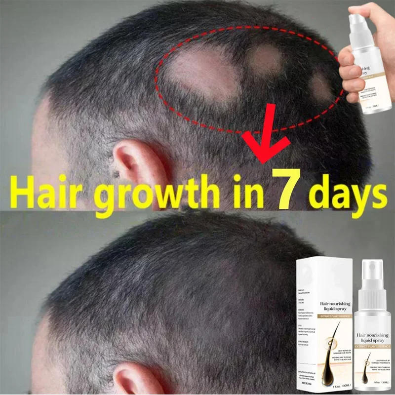 Description Picture 5 of itemGinger Hair Growth Spray Promote Fast Thicker Longer Hair Root Regrowth Serum Prevent Baldness Anti Hair Loss Care for Men Women