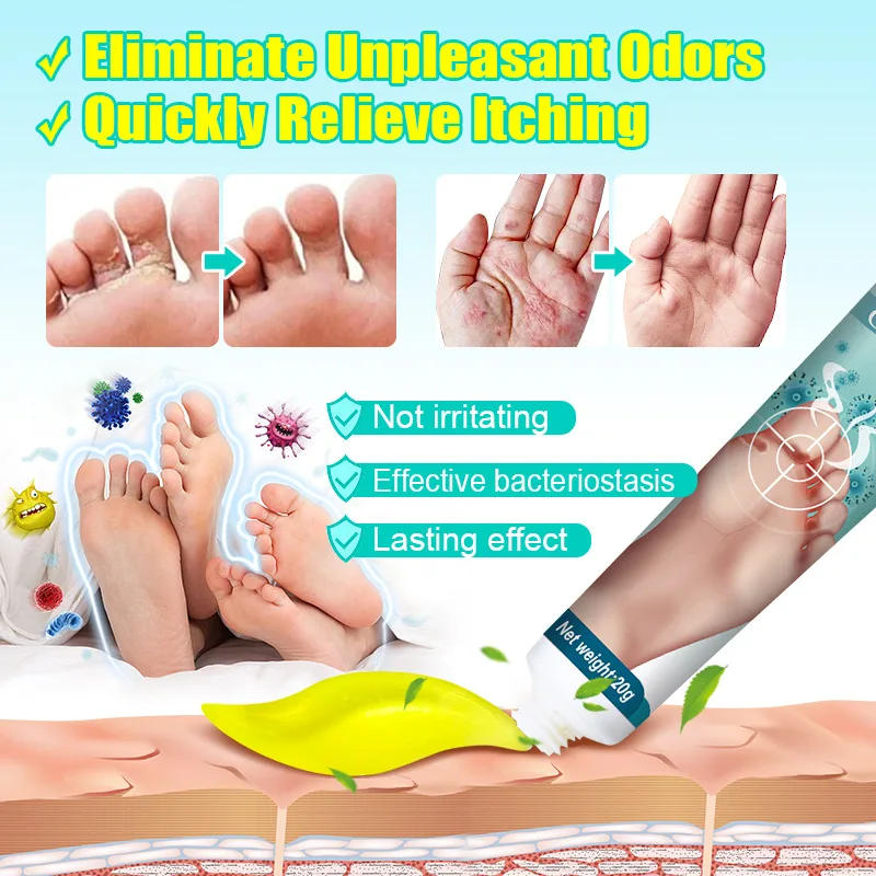 Description Picture 6 of itemFoot Deodorant Cream Foot Odor Bacteriostasis Antipruritic Athlete's Foot Ointment Skin Topical Cream Personal Health Care