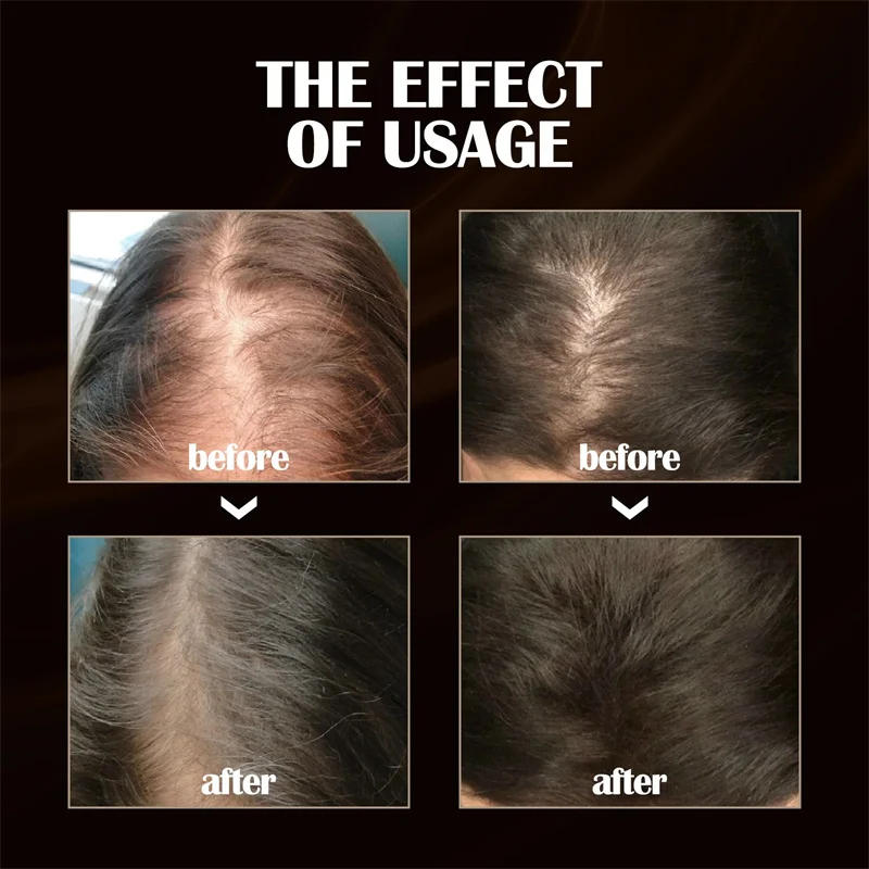 Description Picture 4 of itemPowerful Hair Growth Serum Spray Ginger Anti Hair Loss Treatment Repair Nourish Hair Roots Fast Regrowth Hair Men Women Products