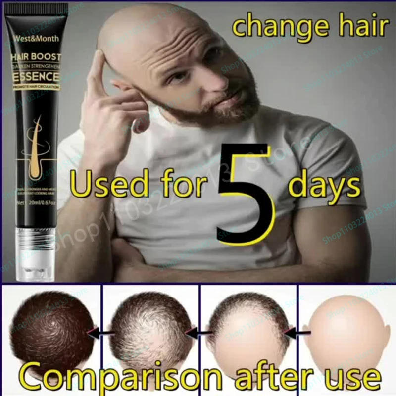 Description Picture 2 of itemStrong Effect Hair Growth Products Ginger Essential Oil 2 Week Treat Hair Loss Scalp Repair Nourish Hair Roots Regrowth