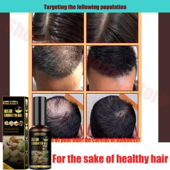 Anti hair loss and hair growth liquid for hair growth, dense hair, and hair fixing herbal plant extract hair essence