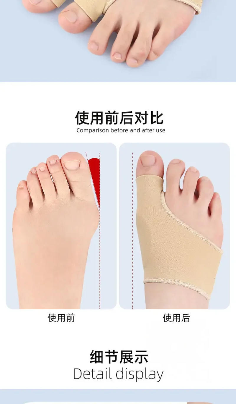 Description Picture 5 of item1pair Big Toe Bunion Corrector Adjustable Orthopedic Socks Toe Separator Pain Relief Hallux Valgus Feet Protector Foot Care Tool