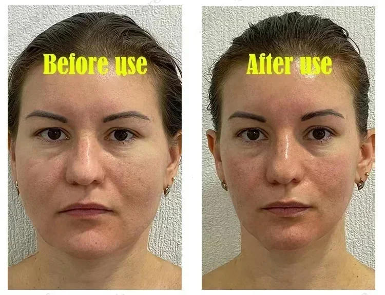 Description Picture 5 of itemEffective V-Shape Face Slimming Lifting Facial Cream Lift Up V Double Chin Cheek Slimming Firming Anti Wrinkle Beauty Skin Care