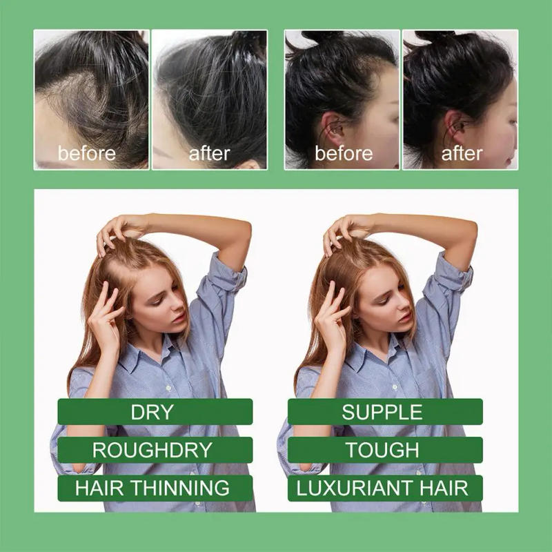 Description Picture 2 of itemRosemary Hair Care Essential Oil Nourishes Hair Roots Of Hair Repairing Improvement Solid Dense Bifurcation 30/50/60ml Hair C7Z6